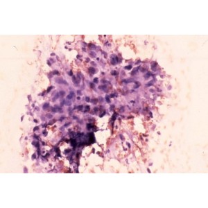 COLORATION CYTOLOGIQUE (3 X 200ML) - Equinvest