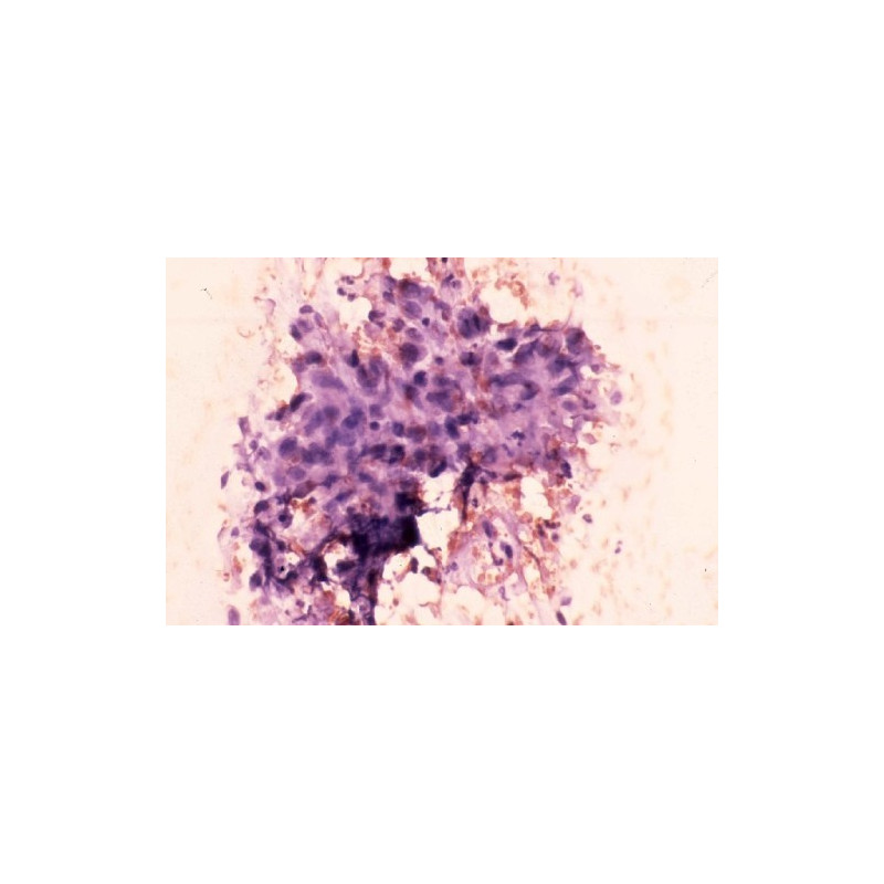 COLORATION CYTOLOGIQUE (3 X 200ML) - Equinvest